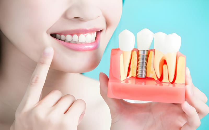 Understanding Oral Surgery: Your Guide to a Healthier Smile