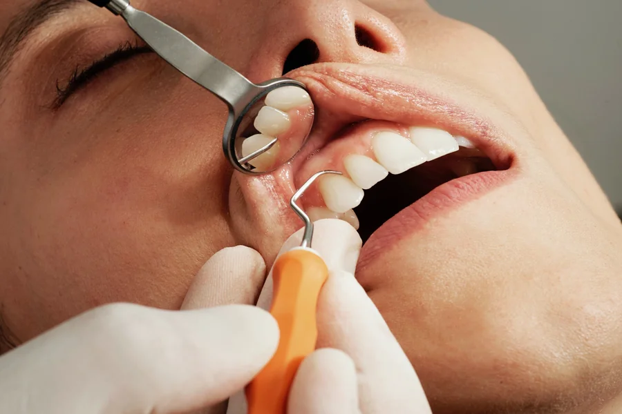 Understanding The Role Of A General Dentist In Your Health Journey Dentist