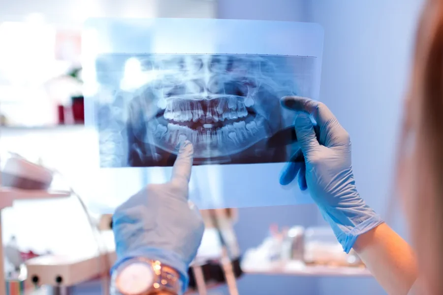 Dental X Rays: Why They Matter In General Dentistry Dental X Rays